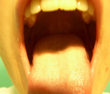 tongue