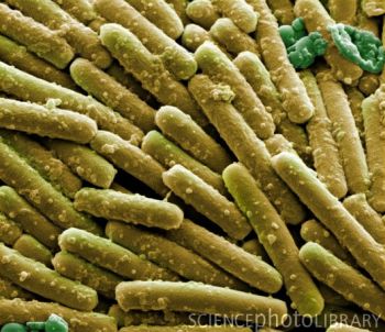 clostridium_difficile_bacteria_sem-spl