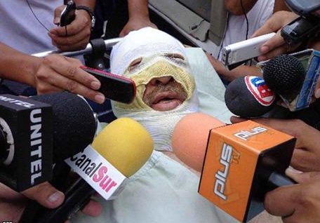periodista_atentado_bolivia